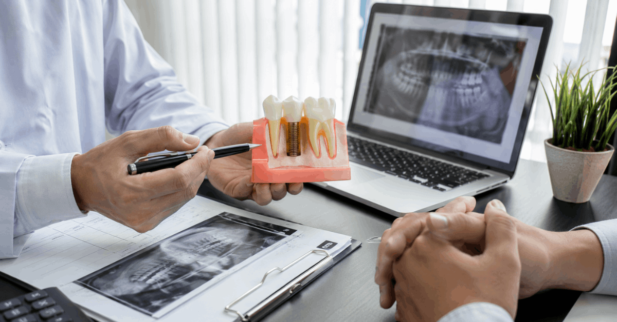 Discover Affordable Dental Implant Options: Compare Prices for Better Savings